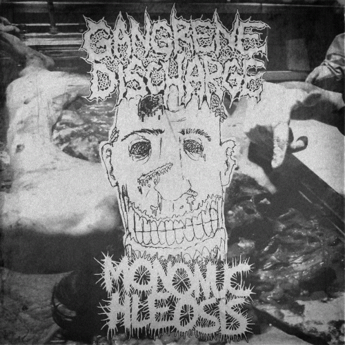 Gangrene Discharge : Mononuchleosis - Gangrene Discharge